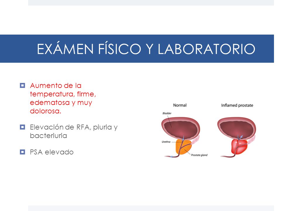 prostata esame clinico